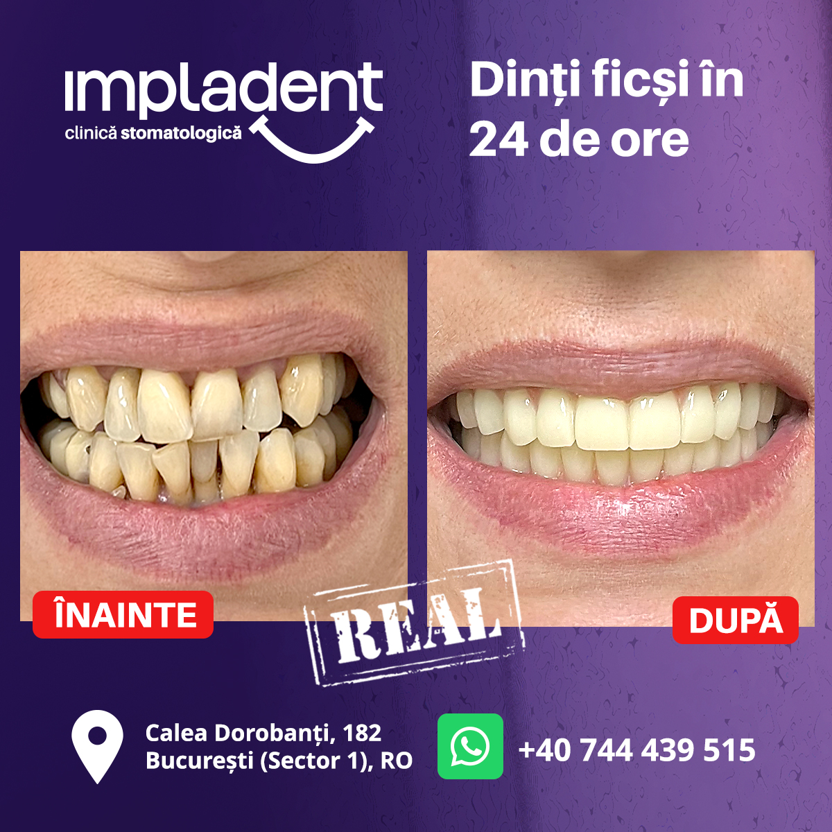 clinica stomatologica bucuresti, cazuri reale before and after