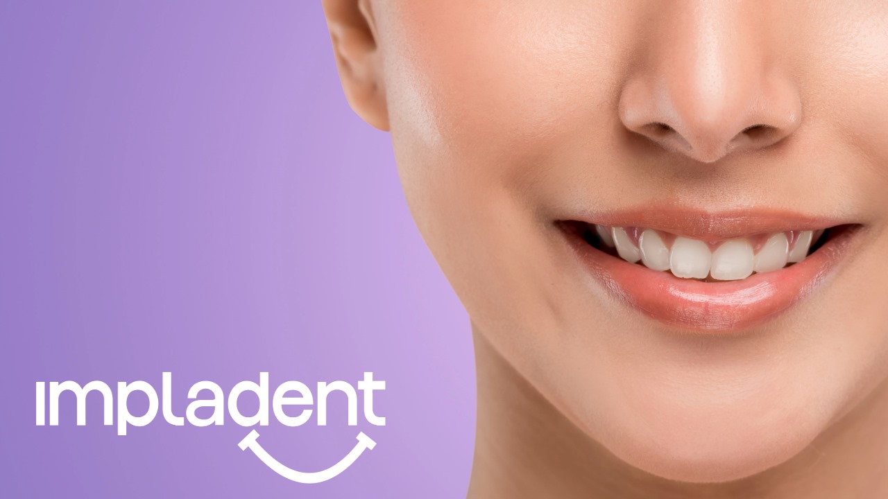 Dinți perfect aliniați cu aparate dentare personalizate: tratament ortodontic la Impladent