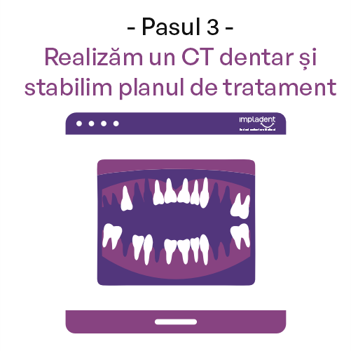 Dinti Ficsi All-on-4 All-on-6 - Clinica IMPLADENT Sector 1 Bucuresti Pasul 3