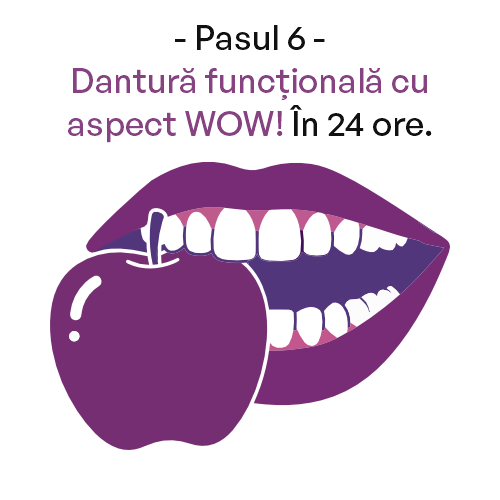 Dinti Ficsi All-on-4 All-on-6 - Clinica IMPLADENT Sector 1 Bucuresti Pasul 6
