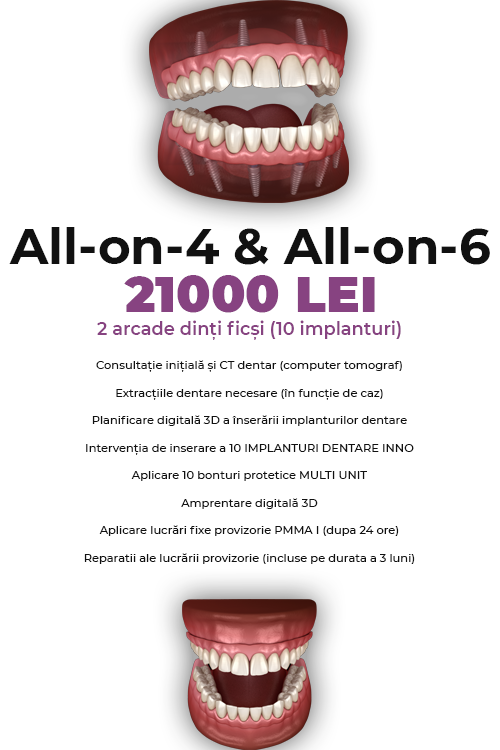 Dinti Ficsi All-on-4 Fast Fixed Ambele Arcade 21000 LEI - Clinica Stomatologică IMPLADENT Sector 1 București
