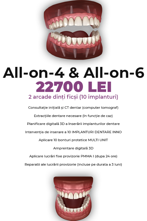Dinti Ficsi All-on-4 Fast Fixed Ambele Arcade 22700 LEI - Clinica Stomatologică IMPLADENT Sector 1 București