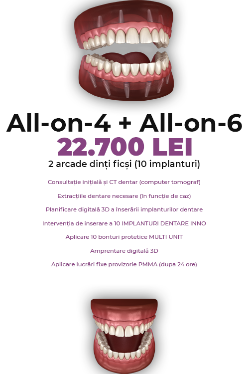 Dinti Ficsi All-on-4 Fast Fixed Ambele Arcade 21000 LEI - Clinica Stomatologică IMPLADENT Sector 1 București