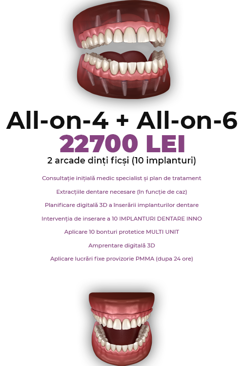 Dinti Ficsi All-on-4 Fast Fixed Ambele Arcade 22700 LEI - Clinica Stomatologică IMPLADENT Sector 1 București